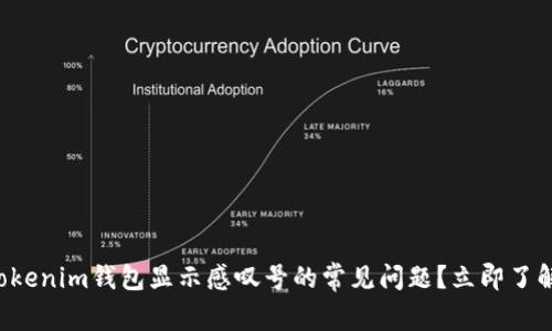 如何解决Tokenim钱包显示感叹号的常见问题？立即了解解决方案！