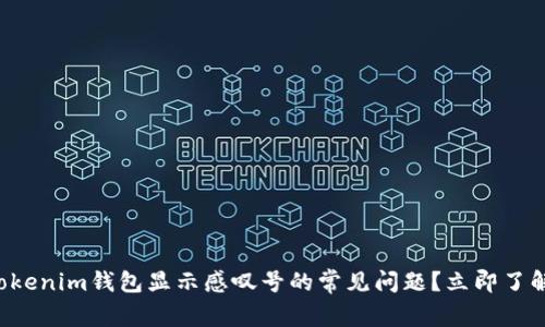 如何解决Tokenim钱包显示感叹号的常见问题？立即了解解决方案！